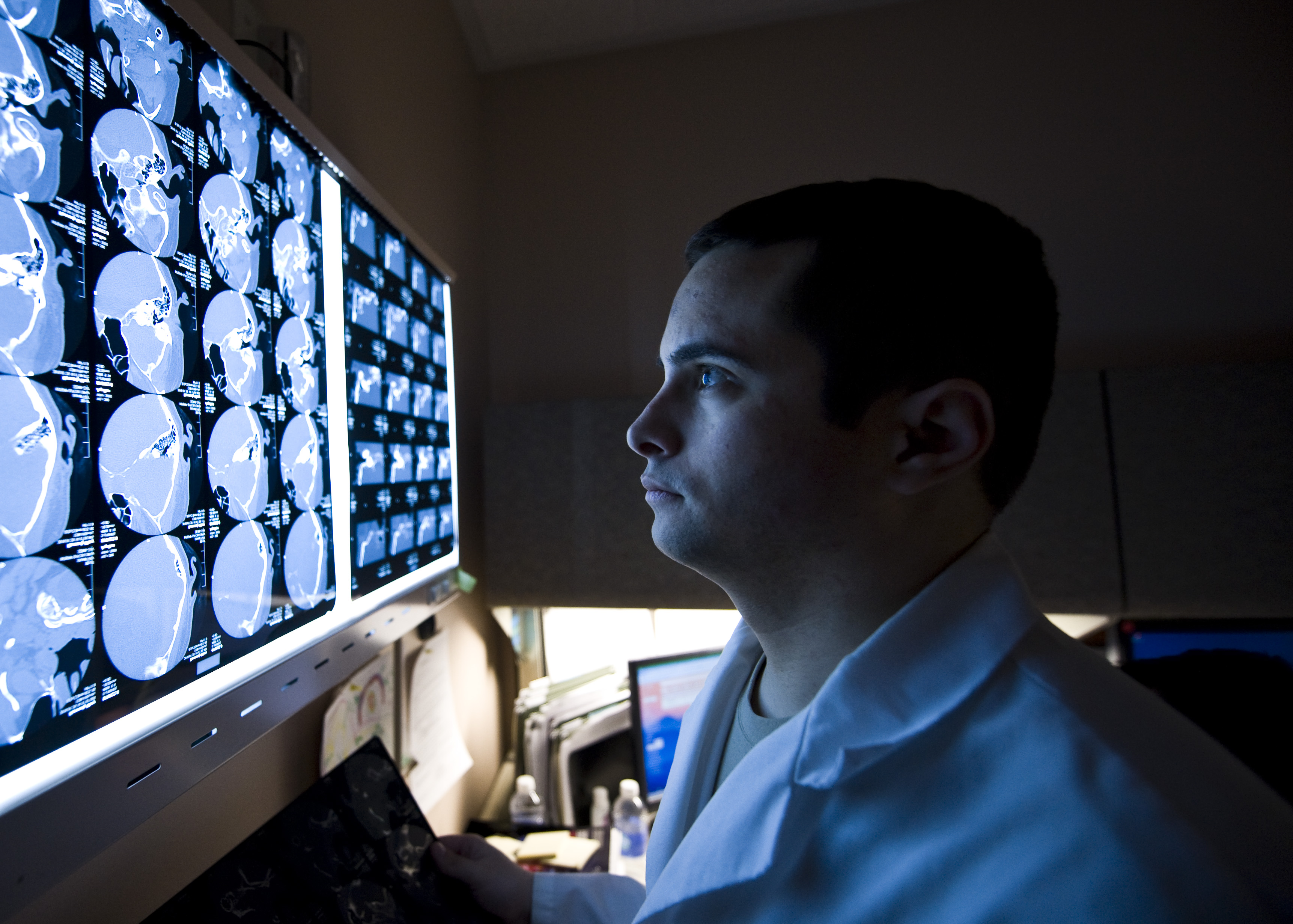 It’s Just A Little Concussion | Vision Learning Center